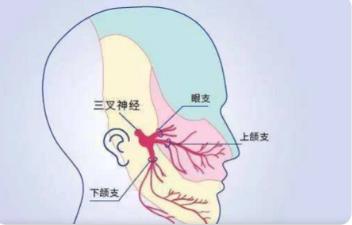 备考22年口腔执业医师必备：三叉神经痛临床表现